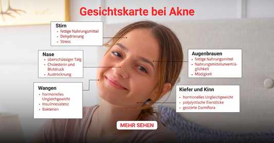 Akne-Gesichtskarte nach Gesichtszonen