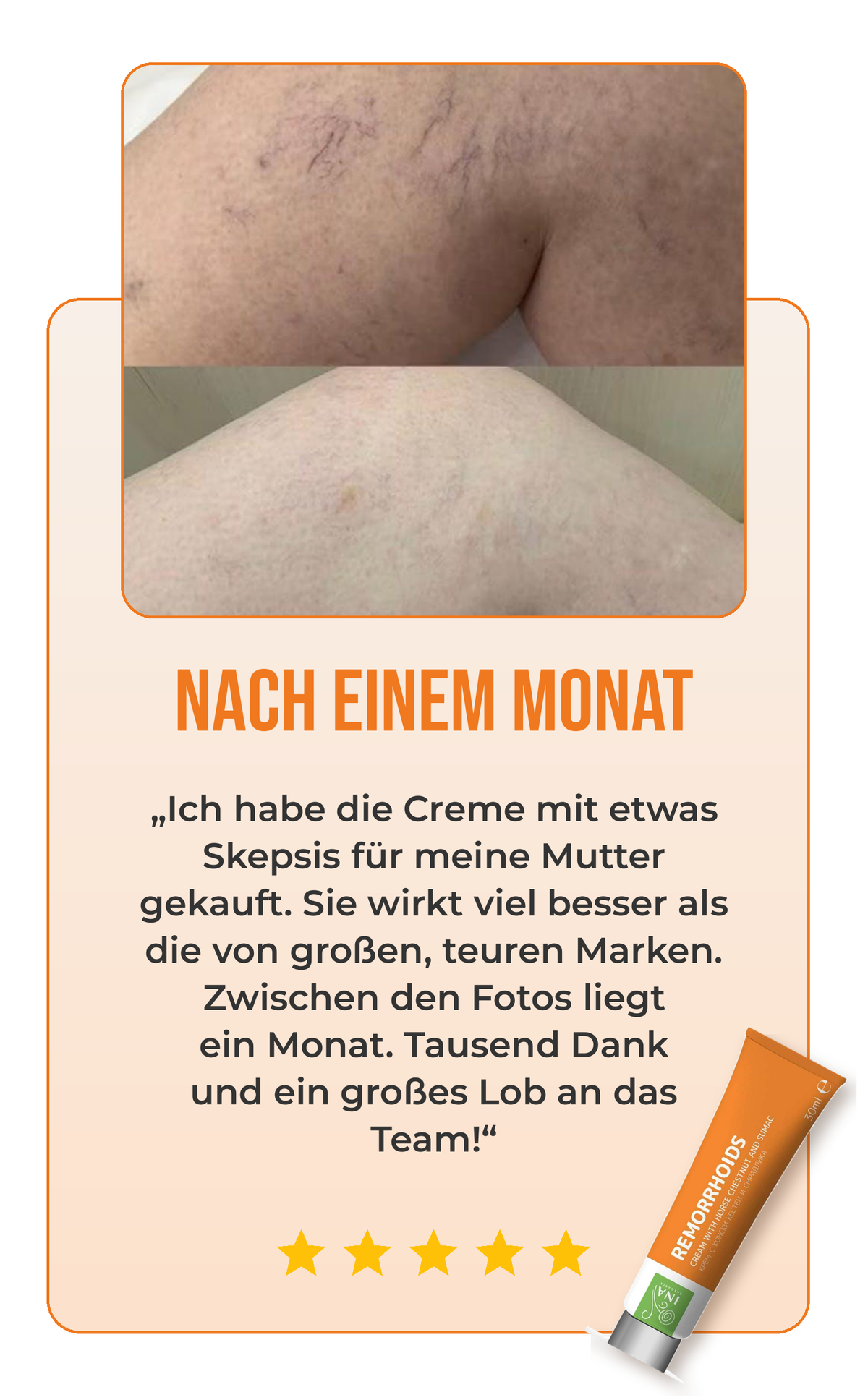Bewertung Creme für Krampfadern 1
