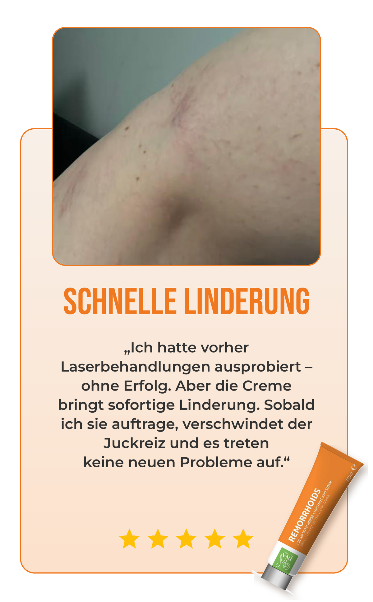 Bewertung Creme für Krampfadern 3
