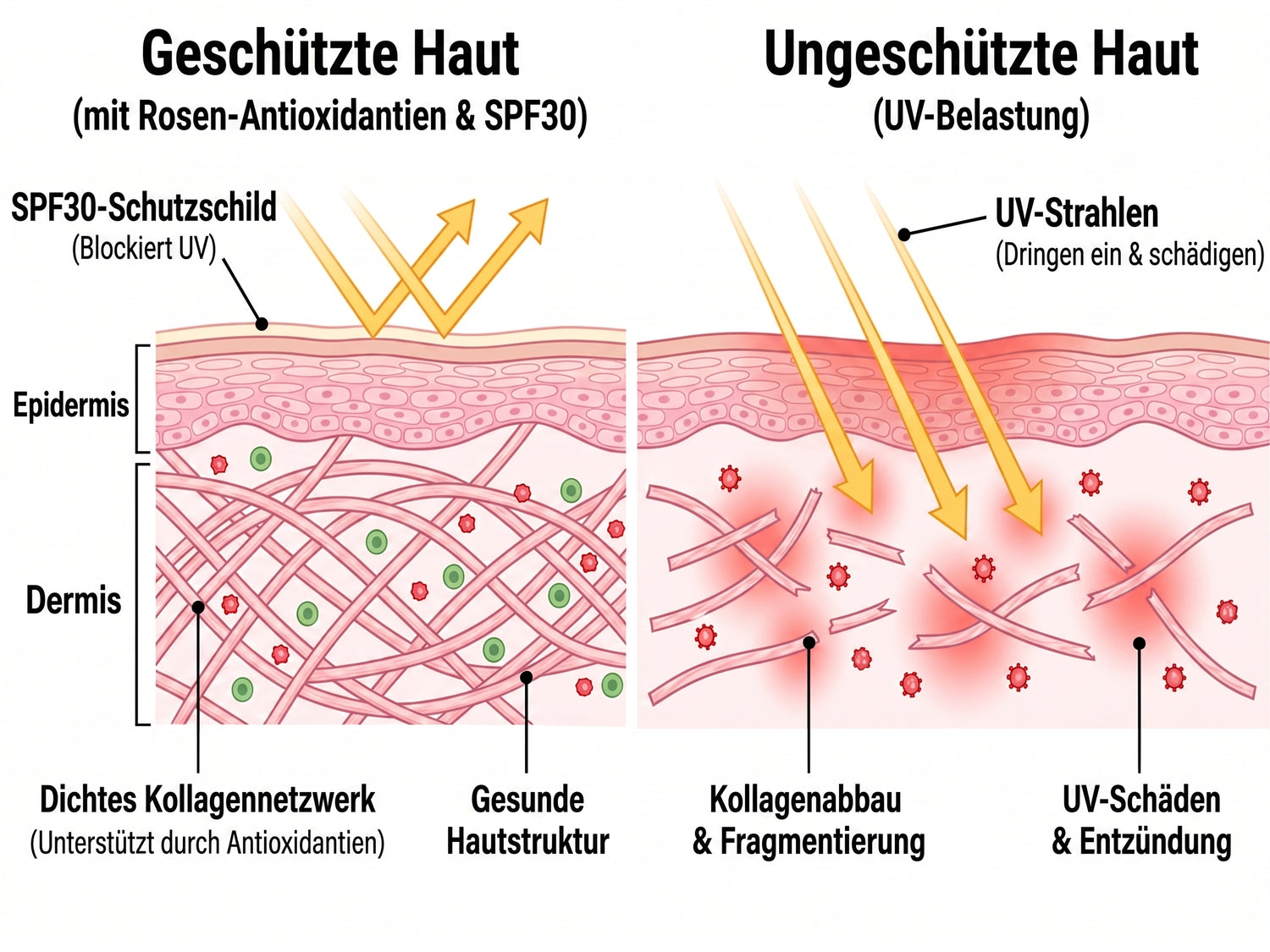 spf DE infographic
